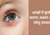 Pimple in eyes: Causes, symptoms, and home remedies