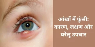 Pimple in eyes: Causes, symptoms, and home remedies