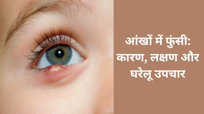 Pimple in eyes: Causes, symptoms, and home remedies