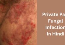 Private Part Fungal Infection In Hindi