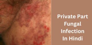 Private Part Fungal Infection In Hindi