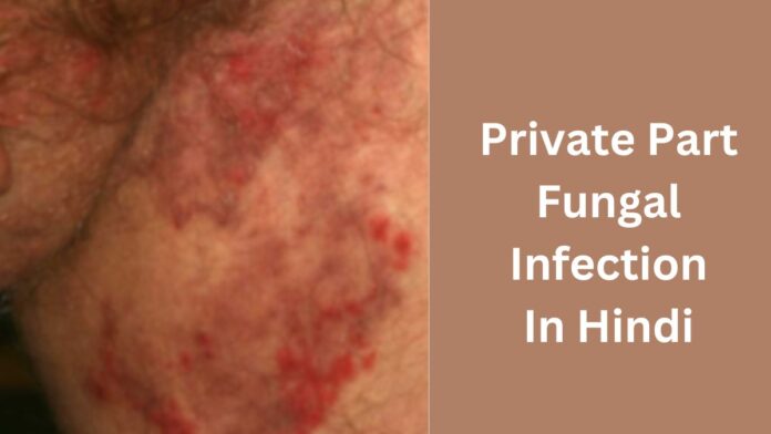 Private Part Fungal Infection In Hindi